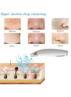 Generic Blackhead Pore Vacuum Cleaner, Facial Pore Cleaner Electric USB Rechargeable Acne Comedone Whitehead Extractor, with LED Display 3 Adjustable Suction Power, Suction Force for All Skin  - Image 3