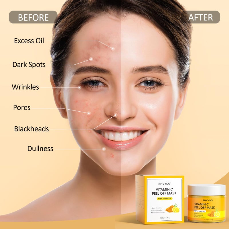 SHVYOG Vitamin C Peel Off Face Mask, Peel Off Mask with Turmeric, Blackhead Remover & Deep Cleansing Face Peel Mask, Vitamin C Exfoliating Face Mask for Blackheads, Large Pores, Dirts, Oil - Image 5