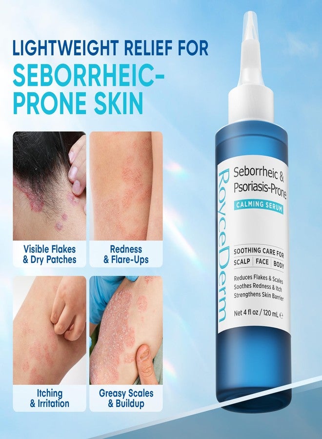 Roycederm Seborrheic & Psoriasis Calming Serum: Clinically Inspired Care for Itch, Dryness, Redness & Flaking - Seborrheic Dermatitis & Psoriasis Scalp Treatment Suitable for Scalp, Face & Body - Image 2