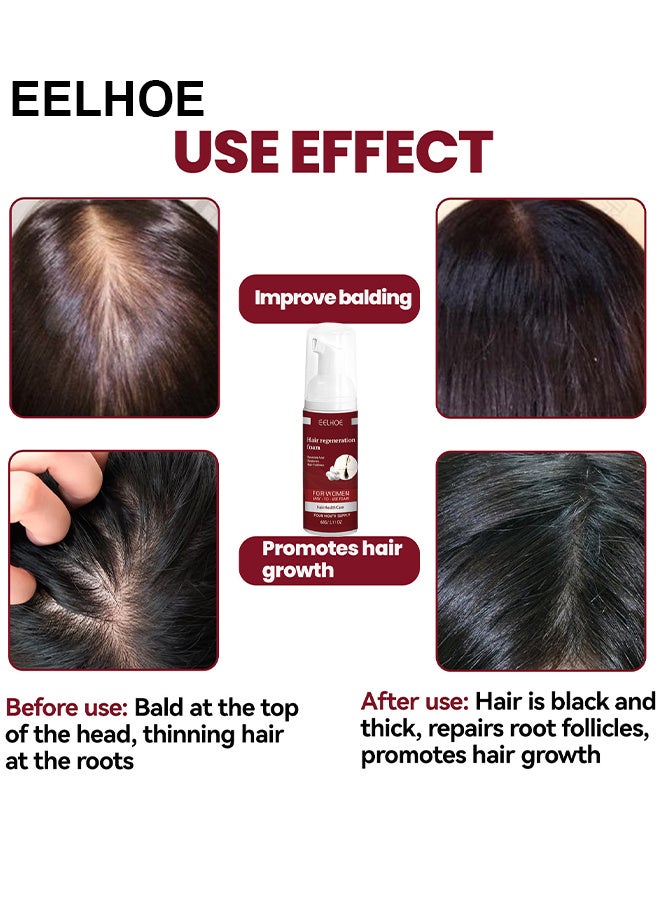 EELHOE Hair Regeneration Foam For Women, Women's 5% Minoxidil Foam For Hair Thinning And Hair Loss, Hair Regeneration Foam Revivies And Restores Hair Follicles 60G
