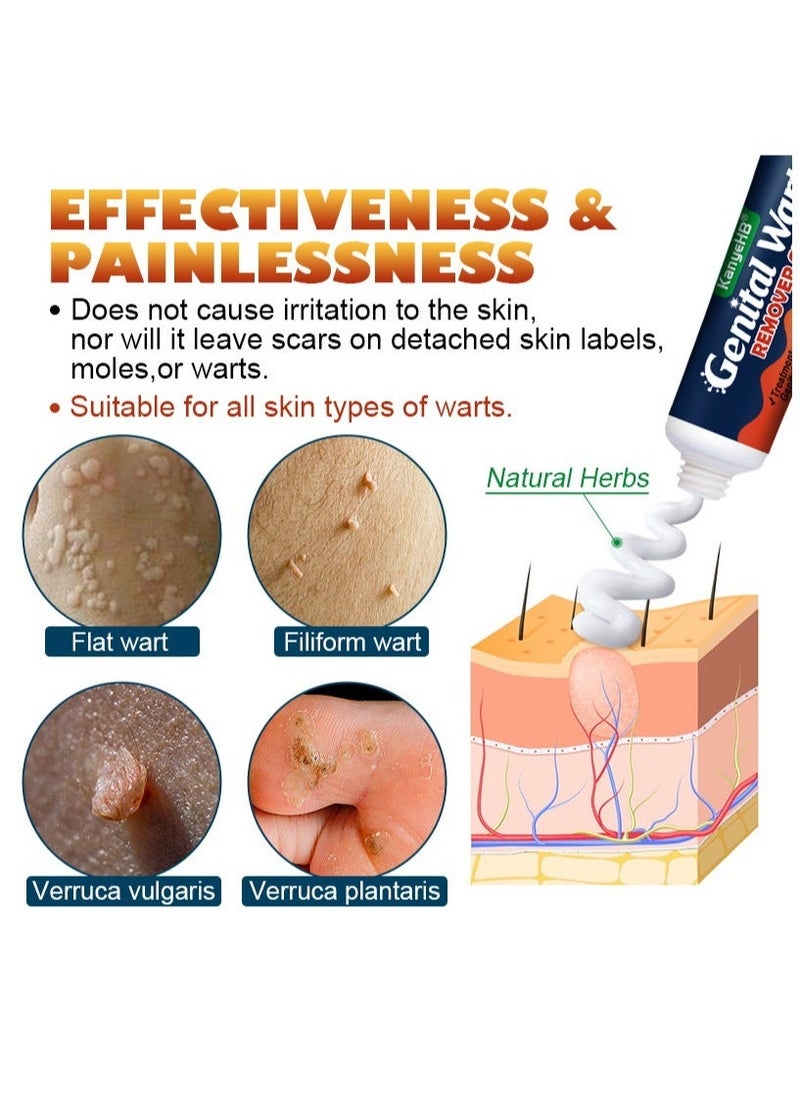 KanyeHB Wart Removal Cream,  Wart Remover for Genital Warts, Plantar Warts, Common Warts, Corns, Wart Cream 20g - Image 2
