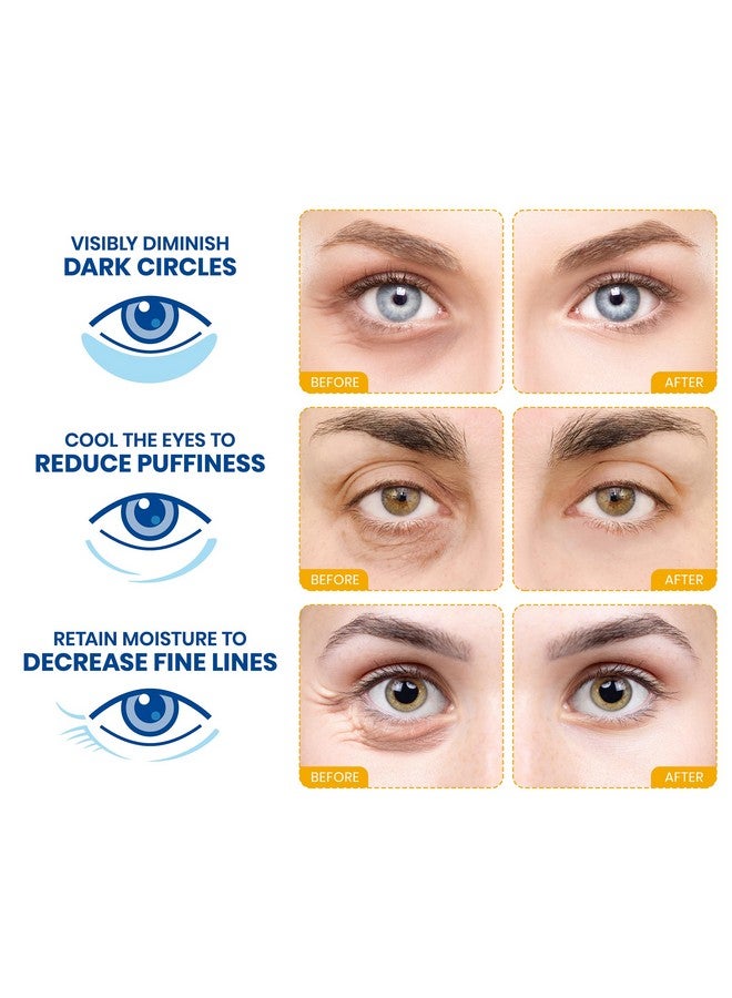 Stylia Under Eye Patches for Dark Circles and Puffy Eyes (15 Pairs) - 24k Gold Collagen Mask with Hyaluronic Acid, Eye Masks for Dark Circles and Puffiness, Gifts for Women, Valentines Day Gifts - Image 2