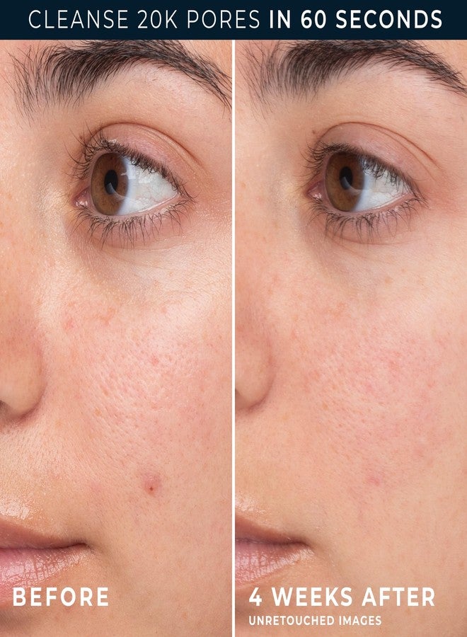 RoC جل روك بارير المتجدد إلى رغوة منظف وجه غير جاف لترطيب البشرة، 12 أونصة - Image 5