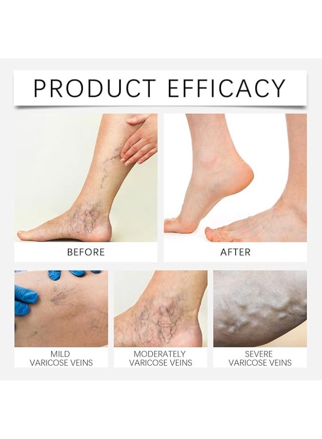 اس كي كيو اي ار 4 حزمة الساق Microneedle التصحيح, ترطيب الساقين Microneedle التصحيحات, المشترك الإغاثة التصحيح, لطيف الدوالي الوريد التصحيحات, للساق الركبة المفصل راحة العظام الصحة التنقل المرونة - Image 2