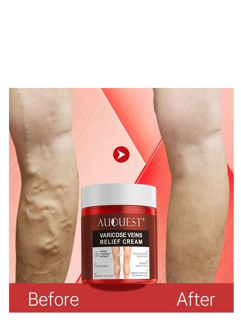 Vein Healing Varicose Veins Treatment Cream Healing Varicose Veins Treatment For Legs Varicose Veins Miracle Cream Improve Blood Circulation Skin Firm Stimulator Cream 80g - pzsku/Z82729FCB296FAF5CC262Z/45/_/1658584204/44d422cd-cbb4-4184-90d7-2c5f18cc677d