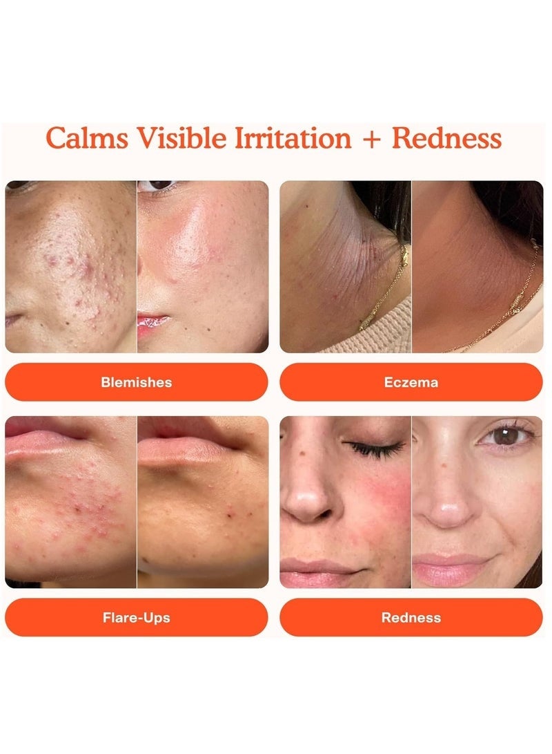 Tower 28 SOS Daily Rescue Facial Spray Miracle pH Balancing Toner Hypochlorous Acid for Ultra Sensitive Skin 4 Fl Oz​ - Image 2