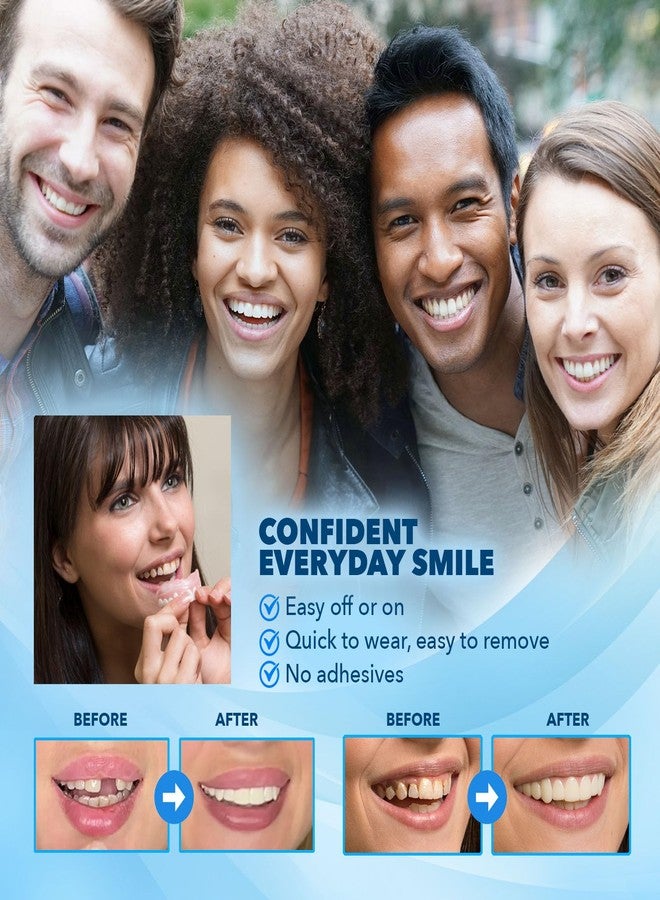 Imako Premium Cosmetic Uppers - 1 Pack - Small, Bleached White - DIY Smile Makeover - Made in USA - Image 2