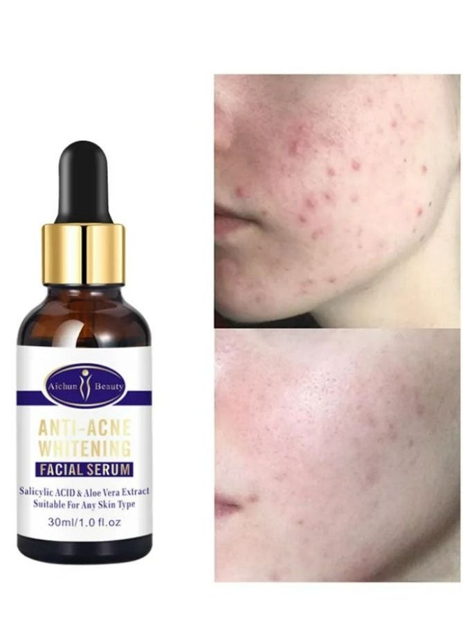Aichun beauty Anti - Acne Facial Serum Aloe Vera Extract Salicylic Acid Repairs Damaged Skin 30 ml  - Image 4