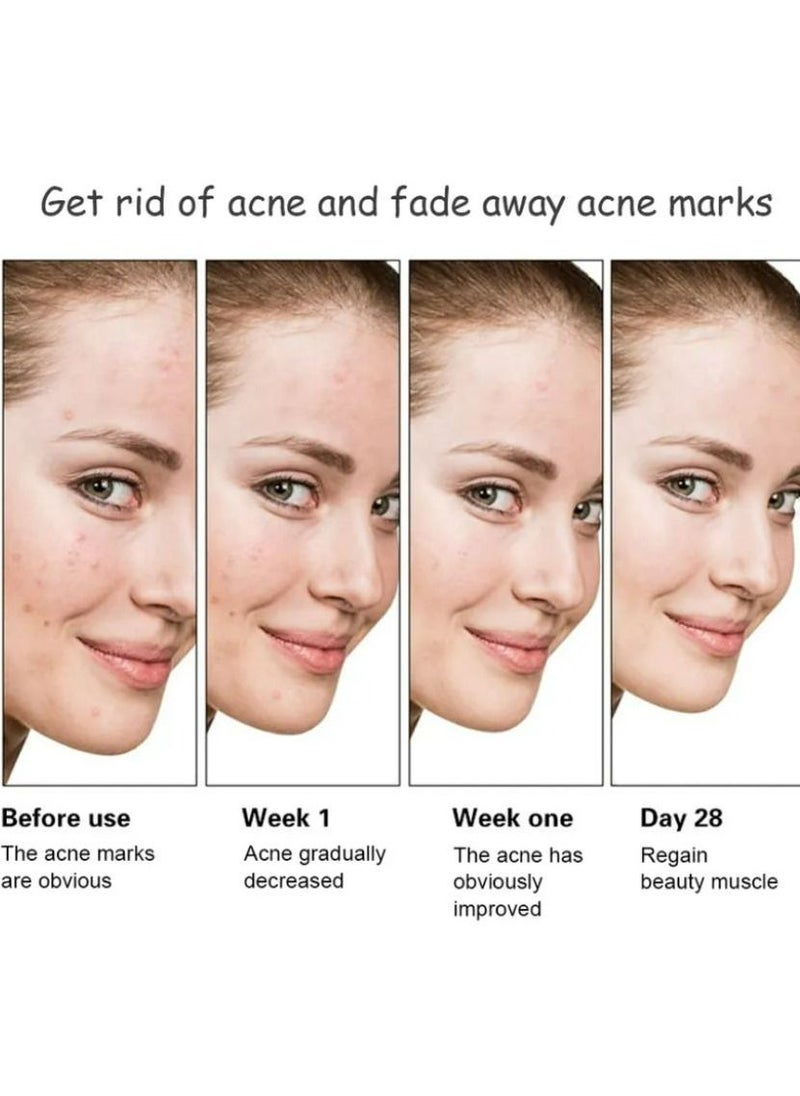 Aichun beauty Anti - Acne Facial Serum Aloe Vera Extract Salicylic Acid Repairs Damaged Skin 30 ml  - Image 3