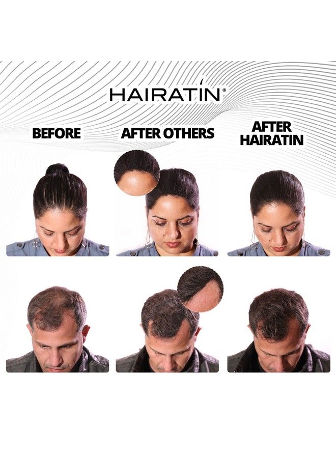 HAIRATIN BY RE-EVOLUTION Hairatin Building Fibers For Thinning Hair Medium Brown 28G Achieve Fuller Natural Looking Results Instantly Conceals Hair Loss In 10 Seconds Thickener & Bald Spot Cover Up For Men & Women - Image 4