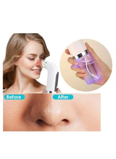 KASTWAVE Blackhead Remover Pore Vacuum Cleaner, Facial Pore Cleaner Comedone Extractor, USB Rechargeable Black Head Suckers with 3 Adjustable Suction Power and 6 Replacement Probes  - Image 2