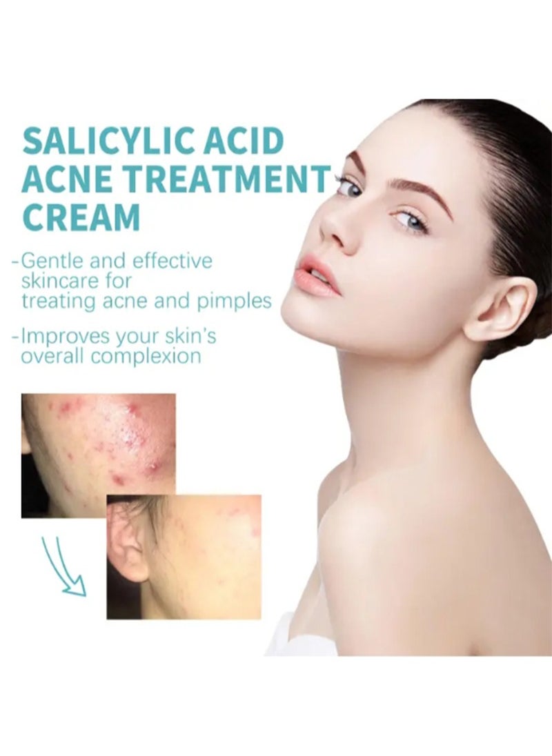 Salicylic Acid Acne Treatment Cream with 0.3% Salicylic Acid and 8 Antibacterial, Anti-inflammatory Ingredients，Whitening Facial Treatment Hyaluronic Acid，Black Dots Remove Skin Care for Oily Skin - pzsku/Z82A25BB68E46F37A8EBFZ/45/_/1705298333/547281a3-a2e1-4c44-9805-a98ff7662940