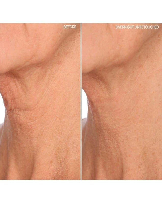 SiO Beauty NeckLift - Neckline Anti-Wrinkle Patch - Overnight Smoothing Silicone Patches For Neck Wrinkles, Fine Lines And Turkey Neck - Image 4