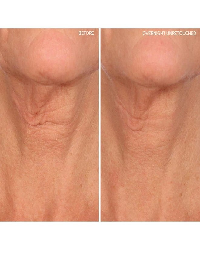 SiO Beauty NeckLift - Neckline Anti-Wrinkle Patch - Overnight Smoothing Silicone Patches For Neck Wrinkles, Fine Lines And Turkey Neck - Image 2