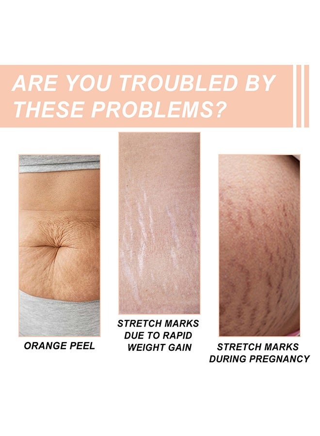 wiieey Snail Essence Pregnancy Stretch Mark Cream, Stretch Marks And Scar Removal Cream For Pregnancy, Stretch Marks Scar Belly Creams For Wrinkles, Obesity Fat Stretch Mark Moisturizing, Remove Marks 60ml - Image 3