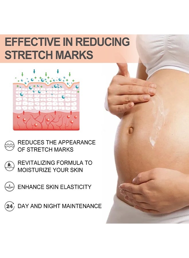 wiieey Snail Essence Pregnancy Stretch Mark Cream, Stretch Marks And Scar Removal Cream For Pregnancy, Stretch Marks Scar Belly Creams For Wrinkles, Obesity Fat Stretch Mark Moisturizing, Remove Marks 60ml - Image 4