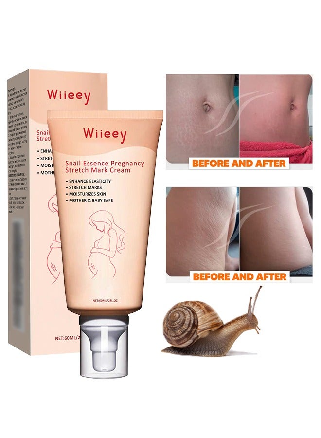wiieey Snail Essence Pregnancy Stretch Mark Cream, Stretch Marks And Scar Removal Cream For Pregnancy, Stretch Marks Scar Belly Creams For Wrinkles, Obesity Fat Stretch Mark Moisturizing, Remove Marks 60ml - Image 1