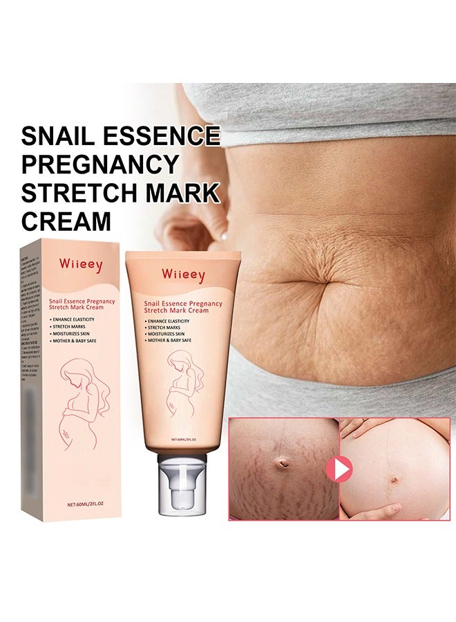 wiieey Snail Essence Pregnancy Stretch Mark Cream, Stretch Marks And Scar Removal Cream For Pregnancy, Stretch Marks Scar Belly Creams For Wrinkles, Obesity Fat Stretch Mark Moisturizing, Remove Marks 60ml - Image 2