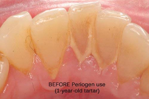 Periogen Complete Oral Health Rinse (3-PK) - Image 4