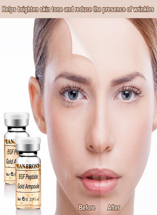 TRESSON BB Booster Serum Kit Serum Hyaluronic Acid Essence Skin Care Kit, EGF Peptide Gold Ampoule 0.27oz 12 Vials,Facial Treatment Increases skin elasticity BB Radiance Facial Serums Kit - Image 3