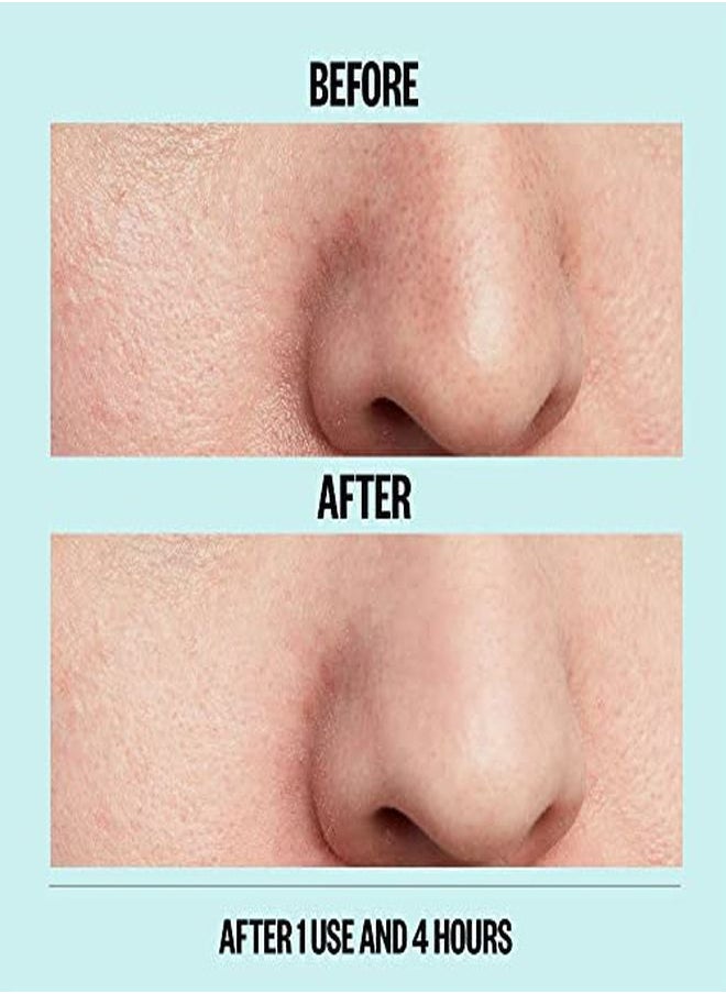 PEACE OUT - Skincare Pores. Hydrocolloid PoreRefining Nose And Face Strips With Vitamin A To Shrink Enlarged Pores And Remove Excess Oil (4 Pore And 4 Nose Strips) - Image 1