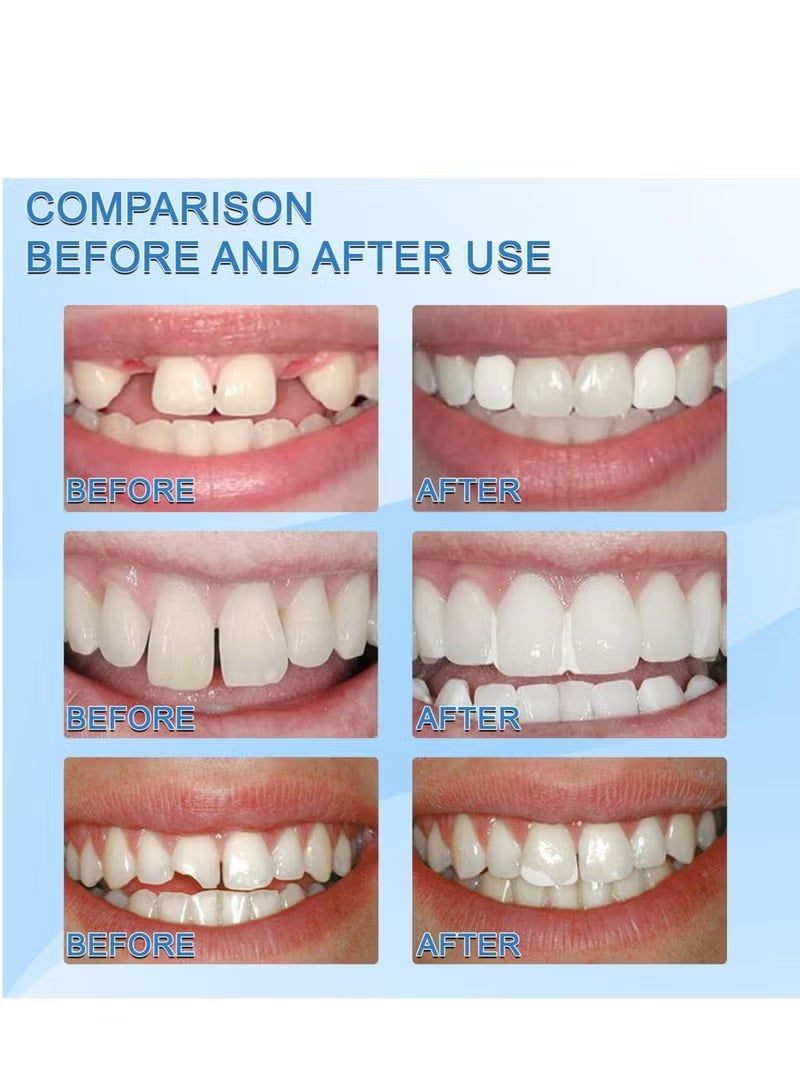 ULHYC 30ml Moldable False Teeth White Particles Reusable Non-toxic Temporarily Fill Regain Smile Cosplay DIY - Image 4