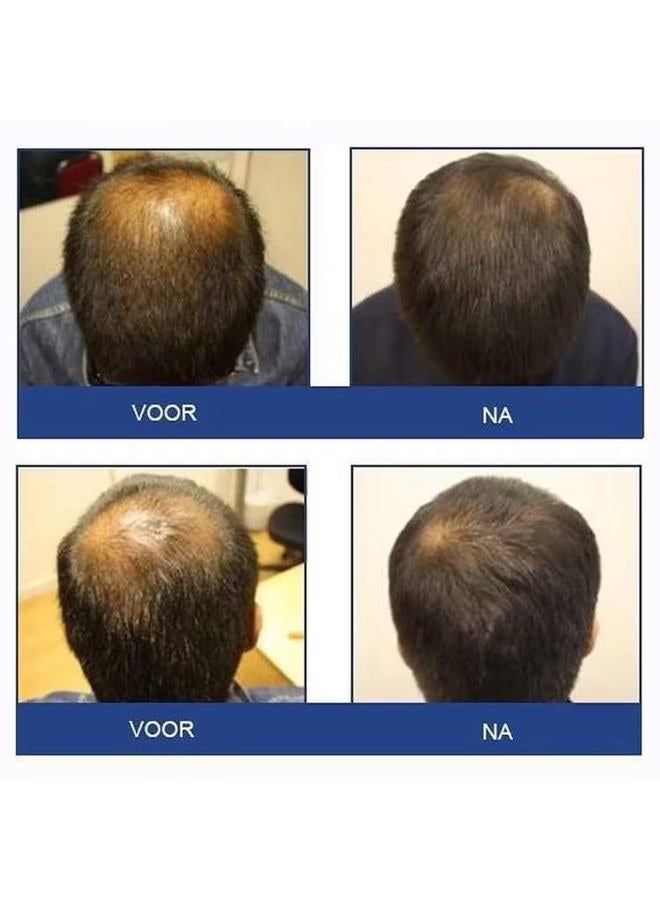 FOLIGAIN Triple Action Shampoo For Thinning Hair, Men's Volumizing Shampoo, with 2% Trioxidil 8 Fl. Oz. - Image 4