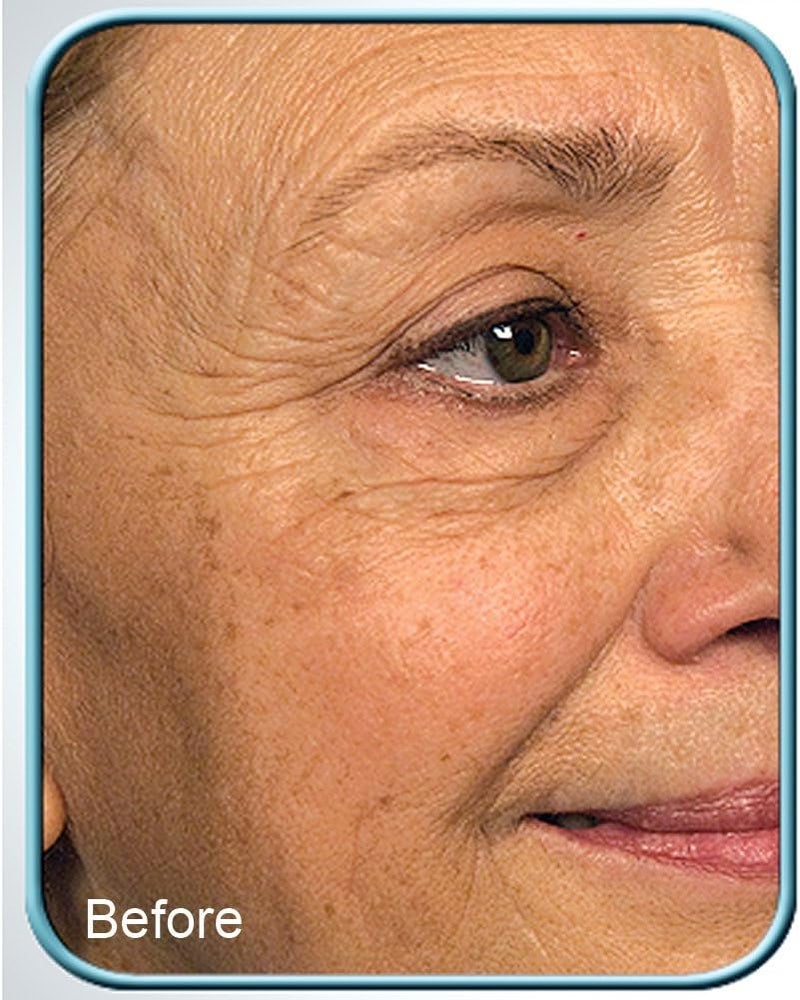 Biologic Solutions Stem Cell Therapy Cream - 1oz Jar for Anti-Aging - Image 2