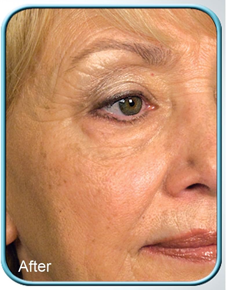 Biologic Solutions Stem Cell Therapy Cream - 1oz Jar for Anti-Aging - Image 3