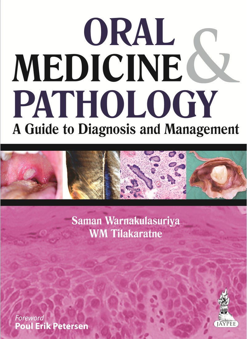 Oral Medicine & Pathology:  A Guide to Diagnosis and Management 