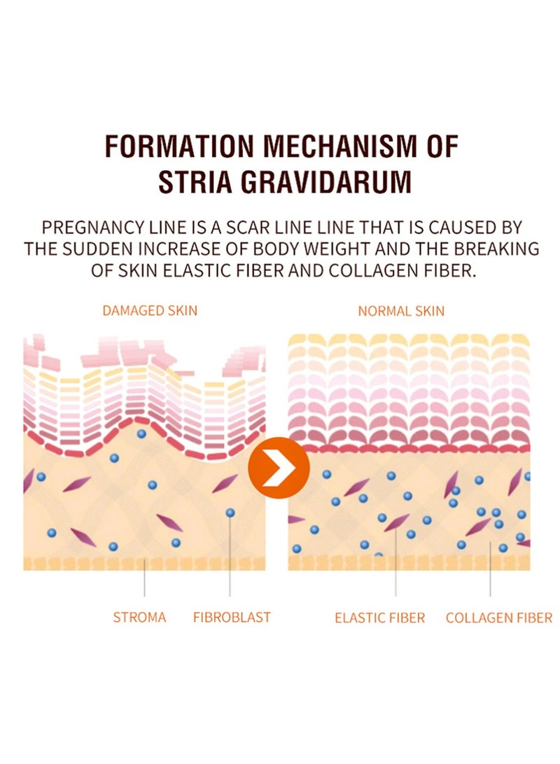 wiieey Stretchmarks Cream Maternity Skin Treatment Pregnancy Scars Repair, Can Promote Cell Regeneration, Repair Necrotic Cells and Enhance Skin Elasticity, Designed For Mother's Stretch Marks - Image 3