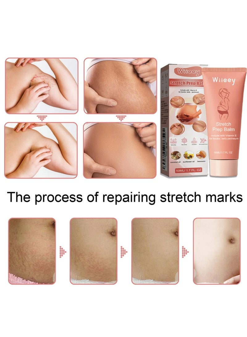 wiieey Stretchmarks Cream Maternity Skin Treatment Pregnancy Scars Repair, Can Promote Cell Regeneration, Repair Necrotic Cells and Enhance Skin Elasticity, Designed For Mother's Stretch Marks - Image 4