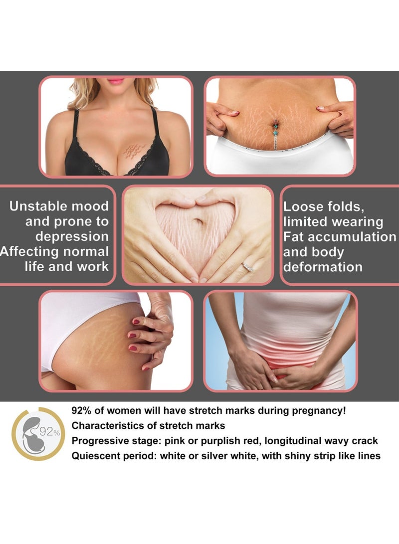 wiieey Stretchmarks Cream Maternity Skin Treatment Pregnancy Scars Repair, Can Promote Cell Regeneration, Repair Necrotic Cells and Enhance Skin Elasticity, Designed For Mother's Stretch Marks - Image 2