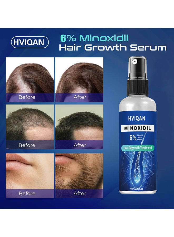 Hviqan 6% Minoxidil Topical Solution, Hair Growth Spray For Men And Women 60Ml Hair Regrowth Treatment Serum For Stronger Thicker Longer Hair Help To Stop Thinning And Loss Hair - Image 4