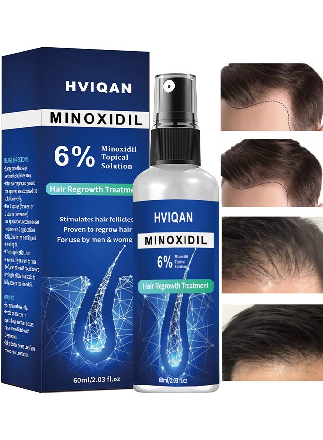 Hviqan 6% Minoxidil Topical Solution, Hair Growth Spray For Men And Women 60Ml Hair Regrowth Treatment Serum For Stronger Thicker Longer Hair Help To Stop Thinning And Loss Hair - Image 1
