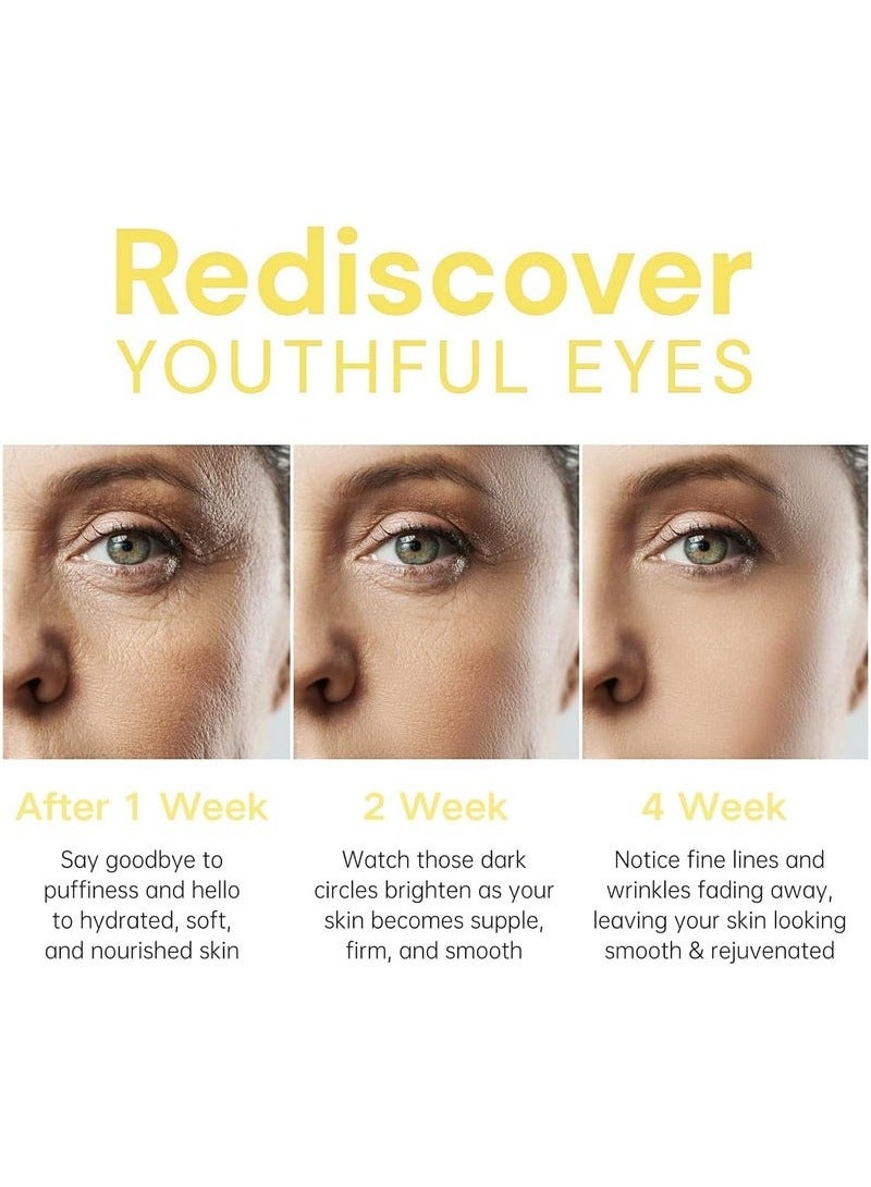 هويجي يكون العين كريم ( 20ml ) ، ومكافحة الشيخوخة كريم العين على الهالات السوداء ، منتفخة العينين والتجاعيد - صيغة غنية بالكافين لشد وترطيب منطقة العين - Image 3