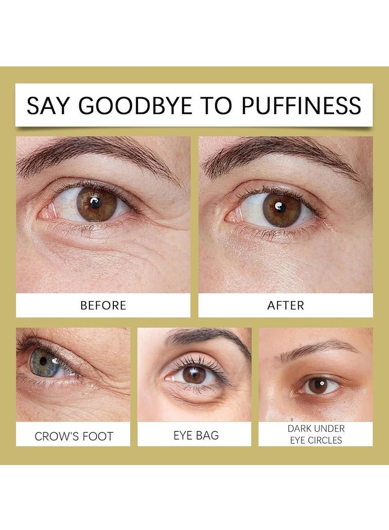 هويجي يكون العين كريم ( 20ml ) ، ومكافحة الشيخوخة كريم العين على الهالات السوداء ، منتفخة العينين والتجاعيد - صيغة غنية بالكافين لشد وترطيب منطقة العين - Image 2