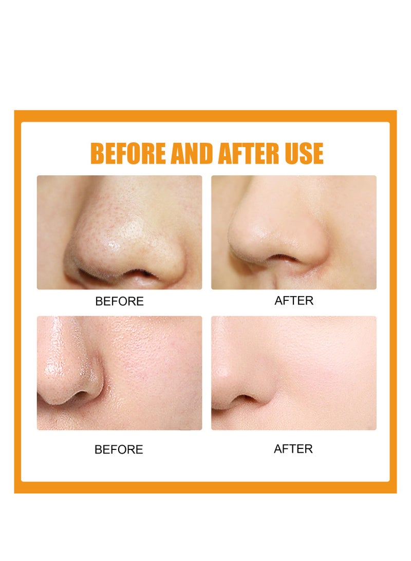 EELHOE Remove nose blackheads and pimples, clean and shrink pores with nose patches(10 Count)Remove nose blackheads and pimples, clean and shrink pores with nose patches(10 Count) - Image 3