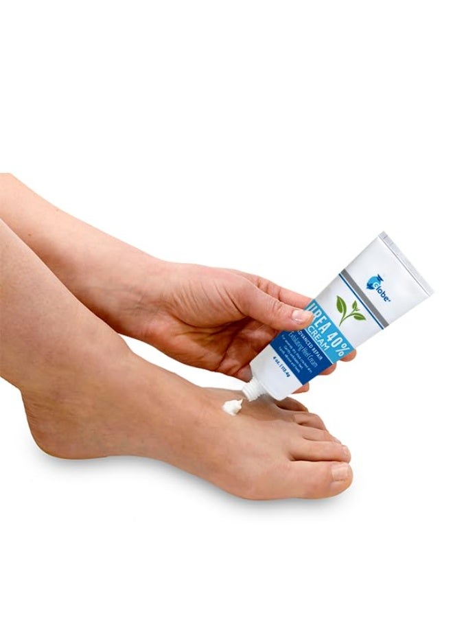 Globe Urea cream 40% - (4 oz) Intensive Hydration for Dry and Cracked Heels, Feet, Hands, Elbows and Knees - Callus Remover, Hydrating Cream for Dry Skin - Helps Athletes Foot - Foot Odor - Image 1