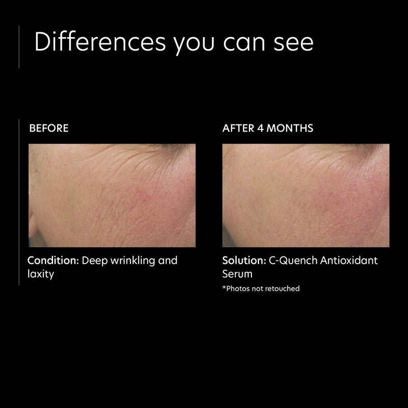 PCA SKIN Vitamin C Quench Antioxidant Protective Face Serum - Anti Aging Hydrating Facial Corrector with Hyaluronic Acid for Fine Lines & Wrinkles, Recommended for Oily & Acne-Prone Skin (1 fl oz) - Image 3