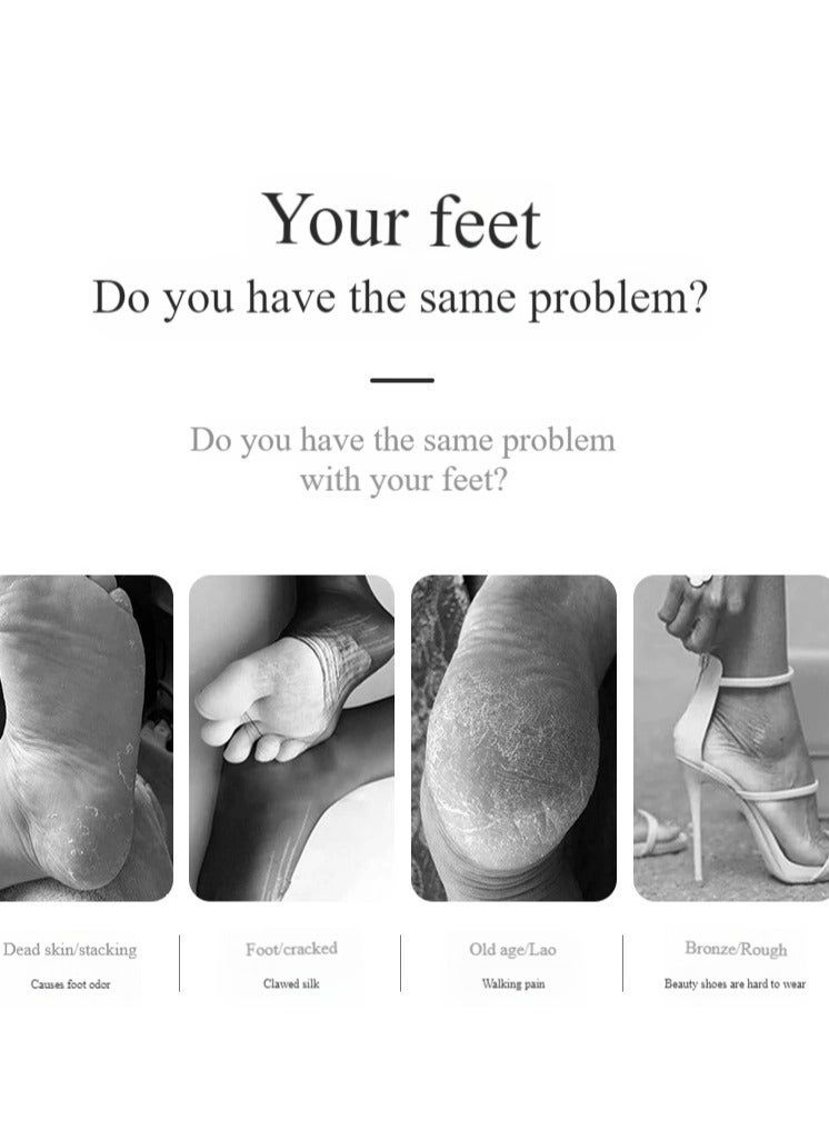 Generic Rechargeable Electric Foot Callus Removal, Professional Foot Tools Foot Care Deceased, Hard Cracked Dry Skin  - Image 4