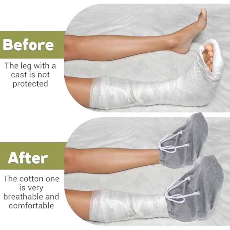 2PCS Cast Sock Cover for Foot, Adjustable Drawstring Leg Cast Sock, Toe Cover Socks Leg Casts Covers Below The Knee, Plaster Socks for Feet, Suitable for Men and Women - Image 4
