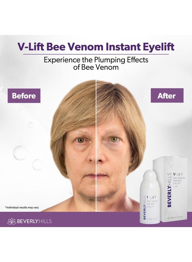 Beverly Hills V-Lift Instant Eye Lift and Eye Tuck Bee Venom Serum for Puffy Eyes, Dark Circles, Wrinkles, and Under Eye Bags Treatment for Women and Men | 30mL (120 Day Supply) - Image 3