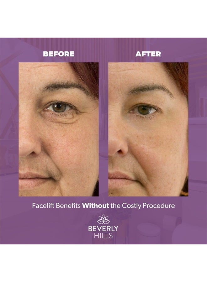 Beverly Hills V-Lift Instant Eye Lift and Eye Tuck Bee Venom Serum for Puffy Eyes, Dark Circles, Wrinkles, and Under Eye Bags Treatment for Women and Men | 30mL (120 Day Supply) - Image 5