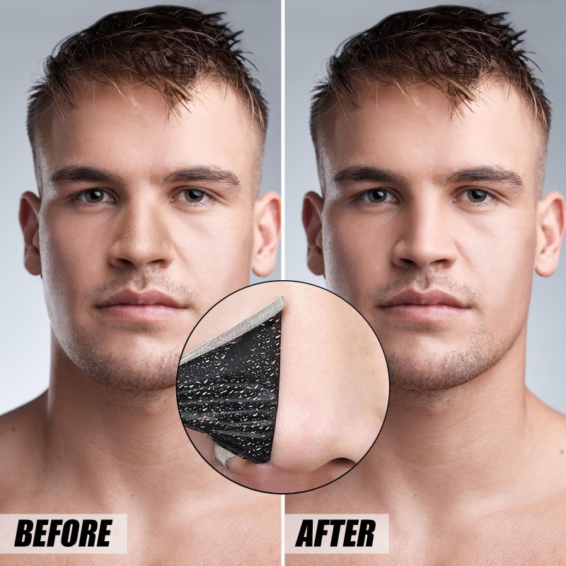 Charmonic 80 Pcs Blackhead Remover Pore Strips, Black Head Remover for Face, Natural Charcoal Nose Strips for Pore Cleaner, Large Size Nose Pore Strip for Men Women for Oil Blackheads & Whiteheads Remover - Image 2