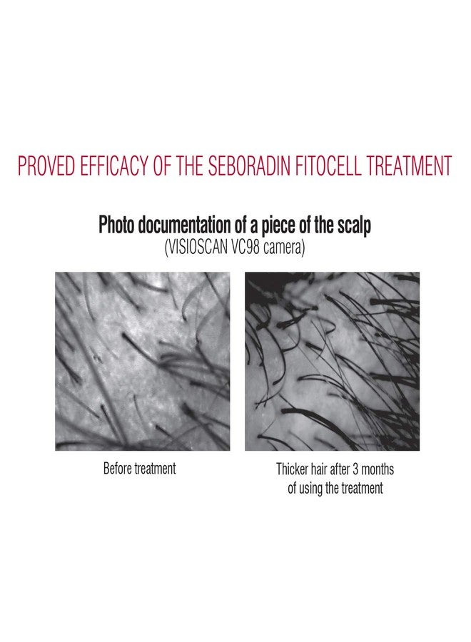 Seboradin Hair Loss and regrowth Fitocell Shampoo with Swiss Technology Stem Cells Phytocelltec Malus Domestica and Biotin, for Men and Women, 200 ml - Image 3