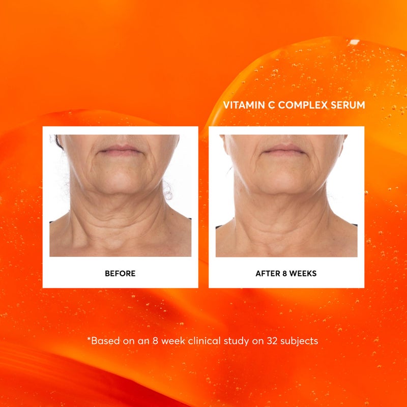 Naturium Vitamin C Complex Face Serum Jumbo, Anti-Aging Facial Treatment with Hyaluronic Acid & Vitamin E, 2 oz - Image 3