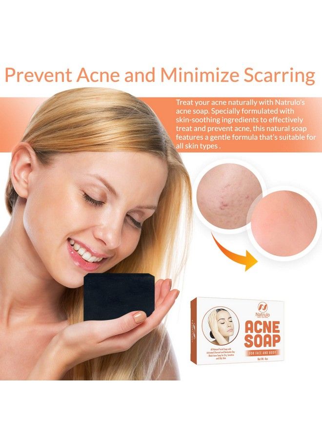 Natrulo Acne Bar Soap With Activated Charcoal & Bentonite Clay Black Acne Soap For Dry Sensitive & Oily Skin All Natural Facial Soap For Pimples & Scars  Homeopathic Acne Treatment Made In Usa  - Image 4