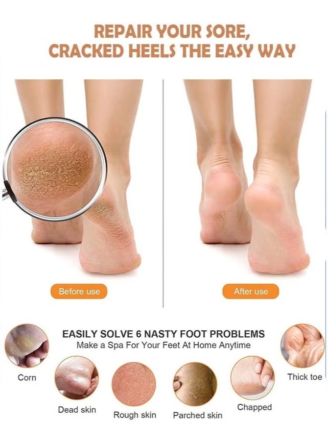 مبرد قدم مزدوج الجانبين للاستخدام الاحترافي، مبرد باديكير لإزالة الجلد الميت وتشقق الكعبين والجلد الجاف، أداة تقشير القدمين مع مقبض مريح للاستخدام المنزلي والصالونات، لإزالة الكالس والعناية بالقدم والكعوب للنساء والرجال، قابل لإعادة الاستخدام وسهل التنظيف - Image 3