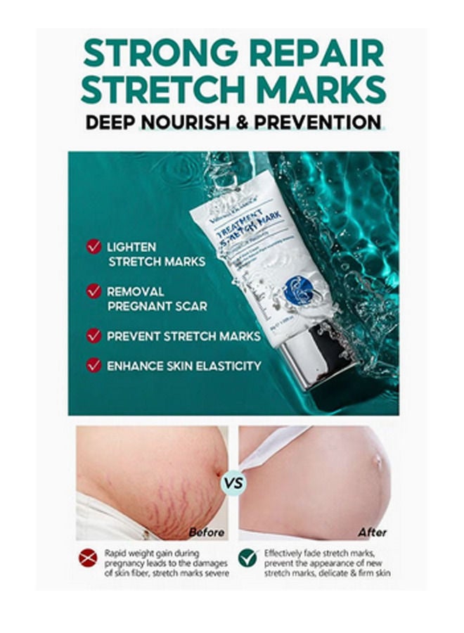 Vibrant Glamour Treatment Stretch Marks Cream 30g - Image 3